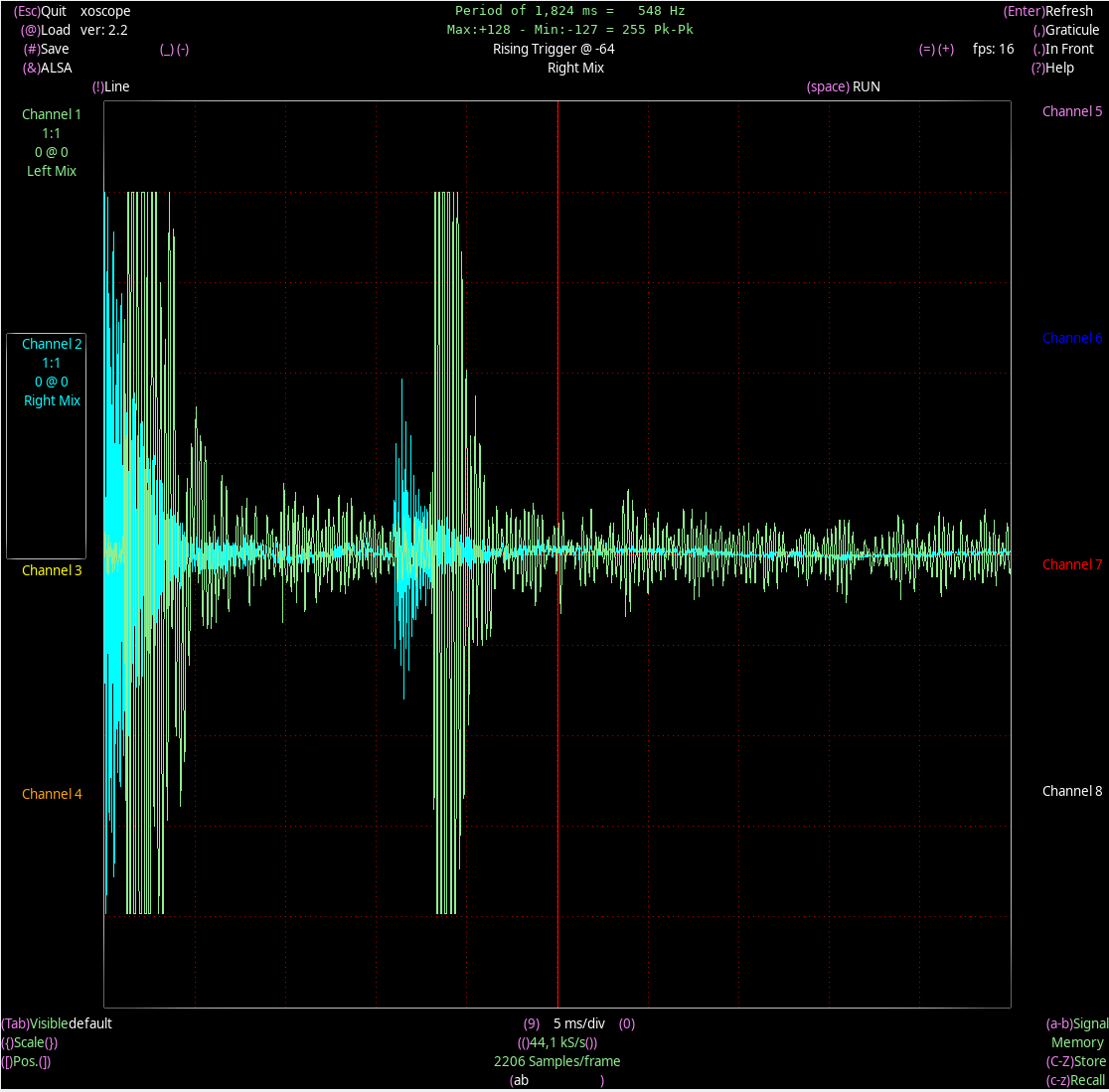 metall-musik-moment-440-5ms.png